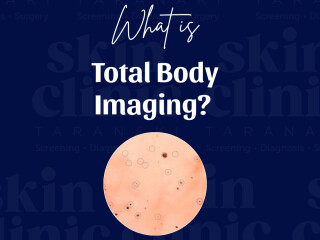 image for what's new at Skin Clinic Taranaki