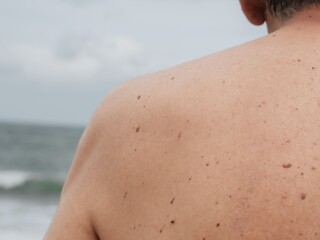 Skin Clinic Taranaki whats new image