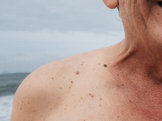 image for what's new at Skin Clinic Taranaki
