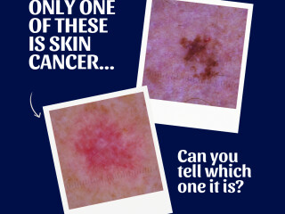 Skin Clinic Taranaki whats new image